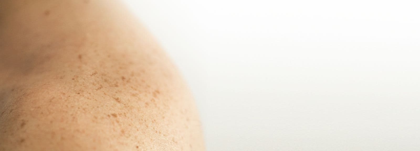 Piel real, primer plano — fotografía editorial