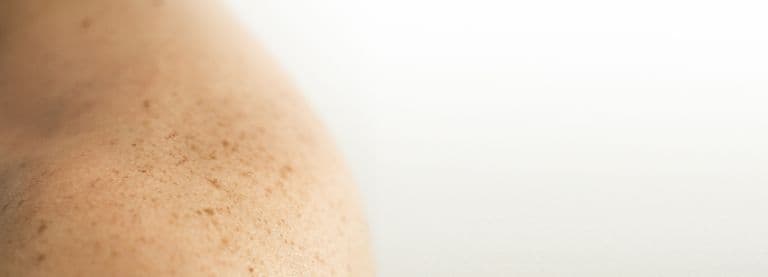 Piel real, primer plano — fotografía editorial